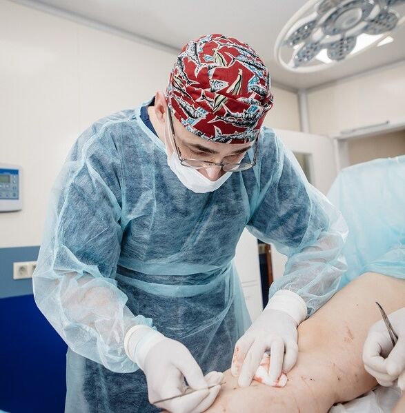 Tratamiento quirúrgico de las varices.