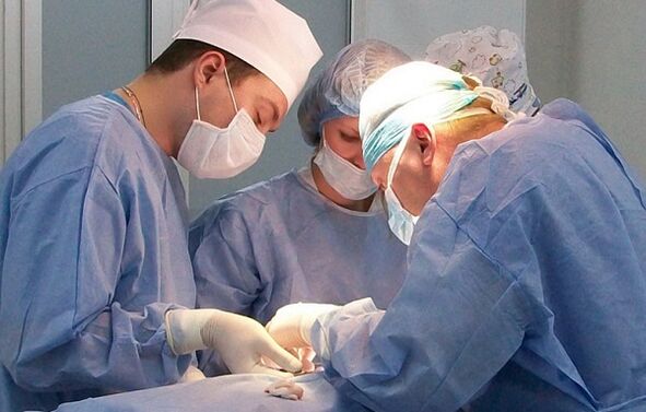 Tratamiento quirúrgico de varices